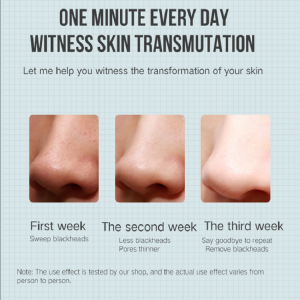 Elektrický extraktor Acne Odstranění Blackhead odstraňovač vakua krása stroj pórový čistič