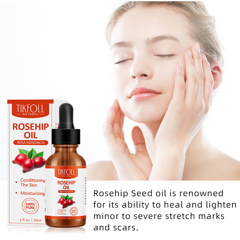 Rosehip Oil