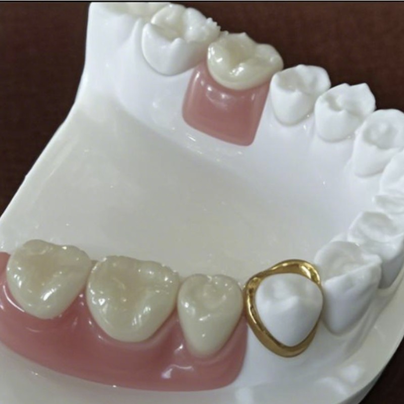 Precision připojení